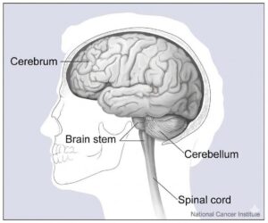 neurogenic dysphagia